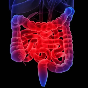 Gastrointestinal Diseases