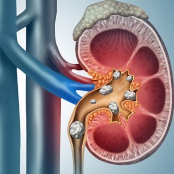 Renal Diseases